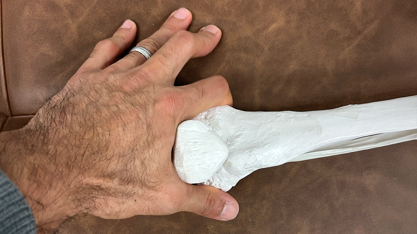 nursemaids knee- knee pain - sarasota FL