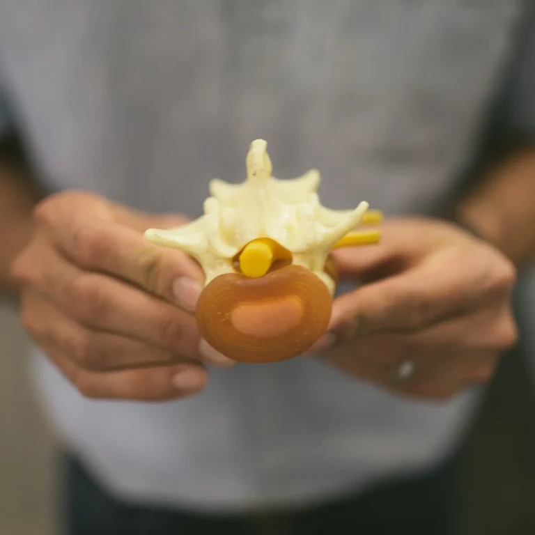 Gonstead Method- spinal display