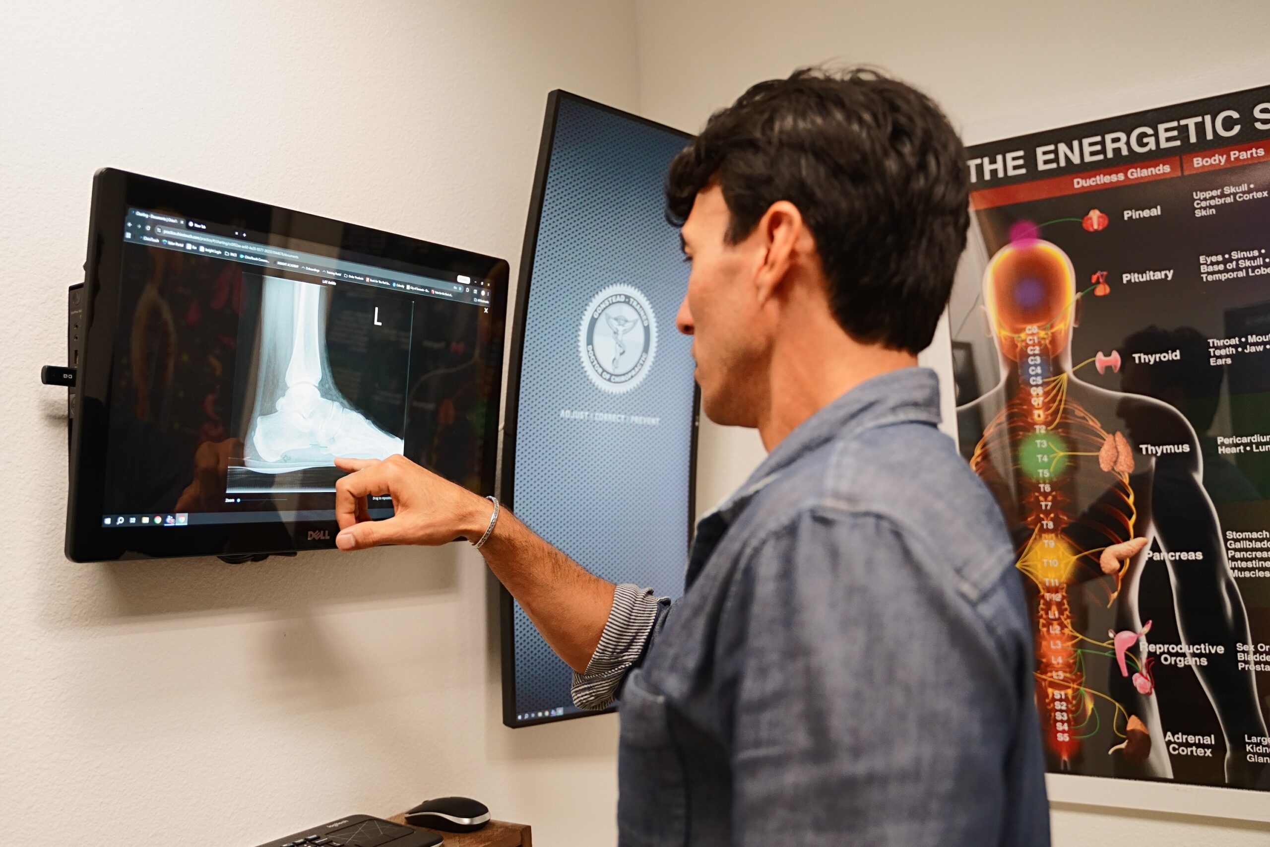 Dr. Bobby Fano reviewing a digital foot and extremity X-ray for precise biomechanical analysis at Vertical Chiropractic in Sarasota.